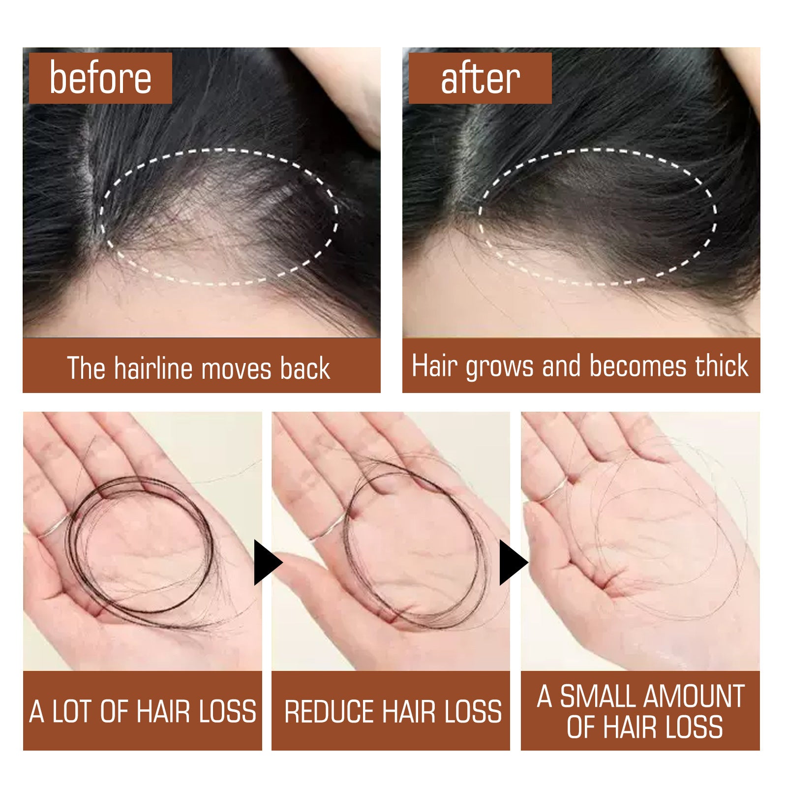Acondicionador para el cabello Aceite de Batana Puro Mascarilla Capilar Alisadora Tratamientos Anticaída Puntas Abiertas Daño Cabello Encrespado
